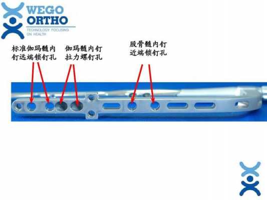 持股钉的简单介绍-图2